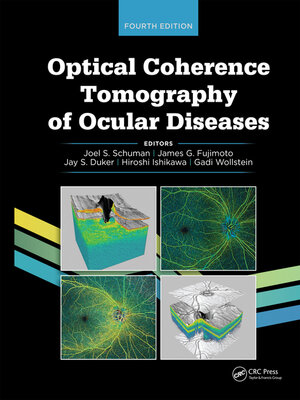 cover image of Optical Coherence Tomography of Ocular Diseases